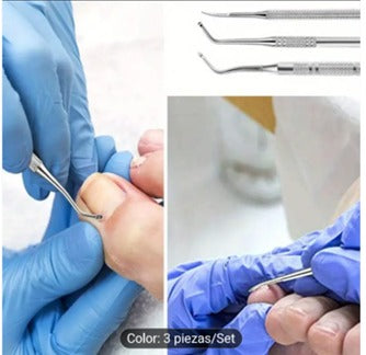 Kit Profesional para Onicocriptosis (Uñas Encarnadas) 3 Piezas